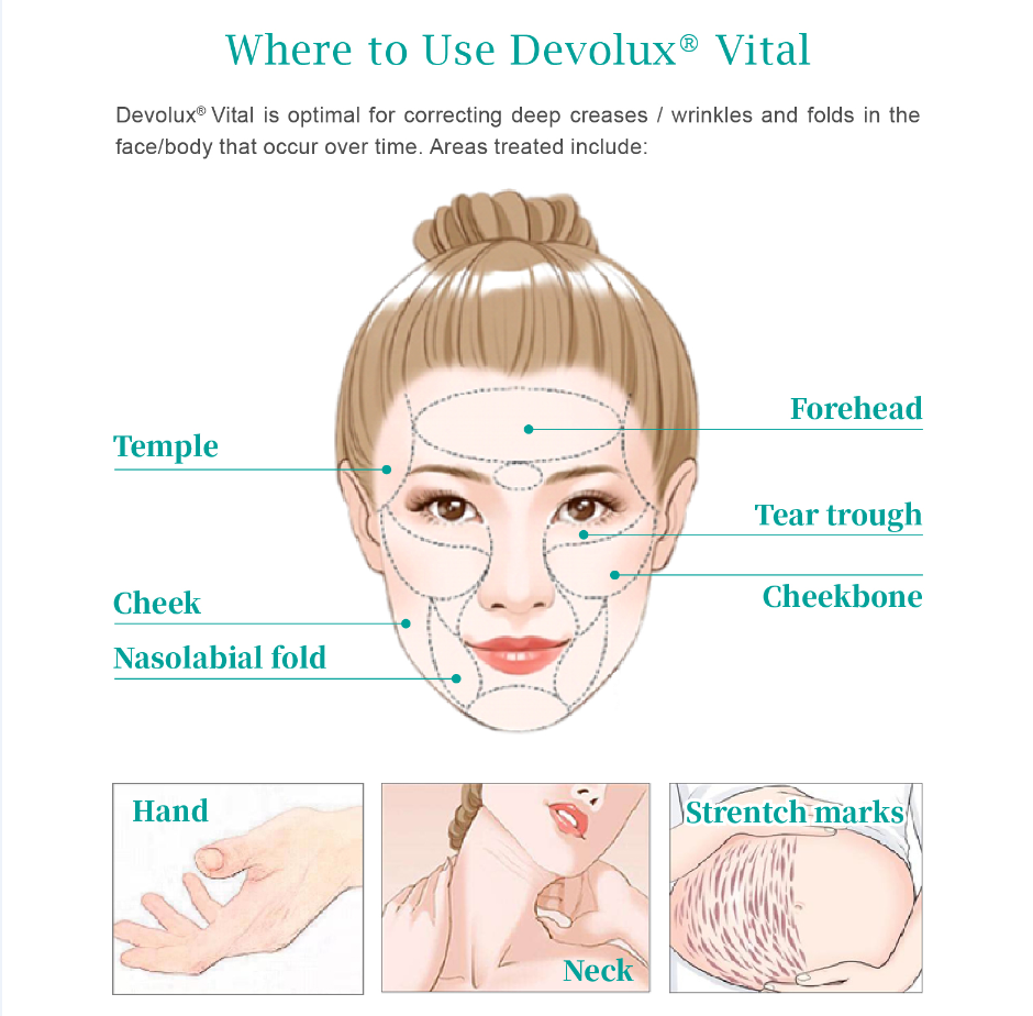 treatment areas for devolux vital