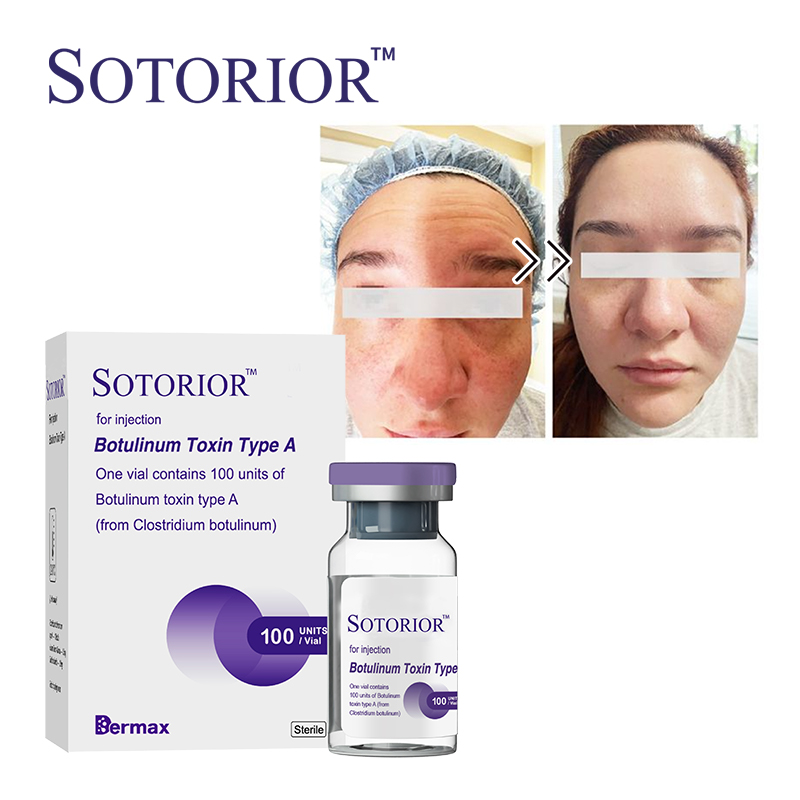 sotorior botulinum toxin