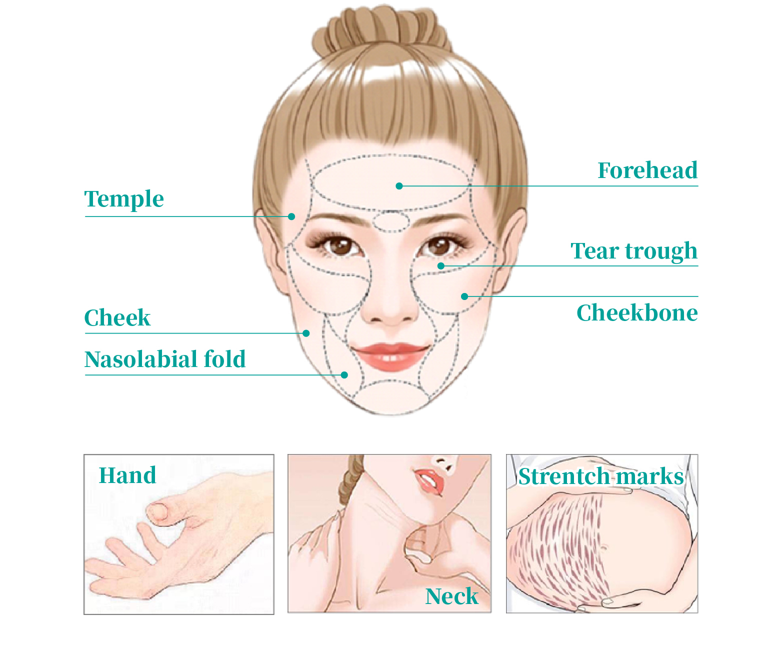 treating face with plla