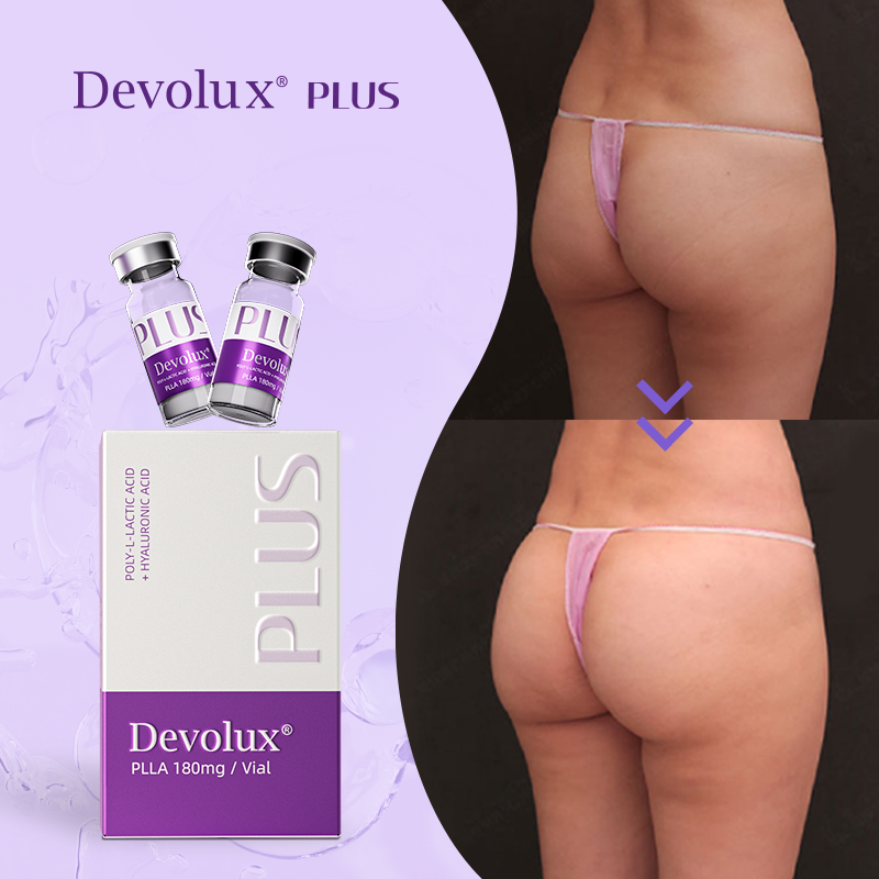 plla buttock injection before and after pictures