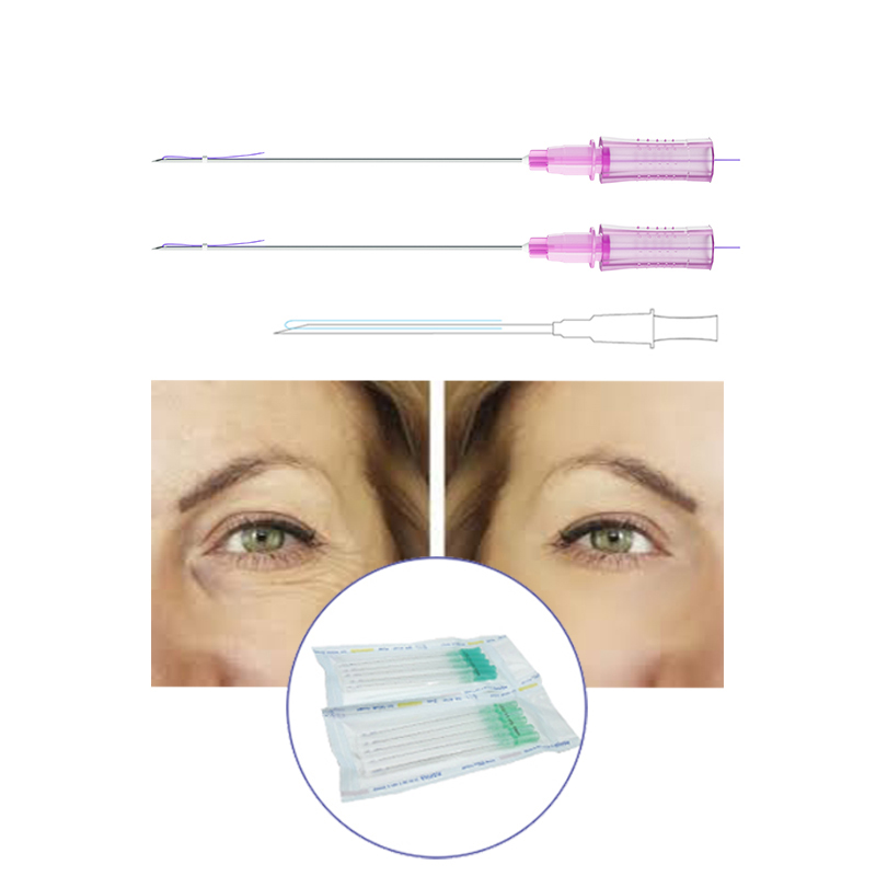 Magik Thread Before And After PDO Thread Lift For Eyes