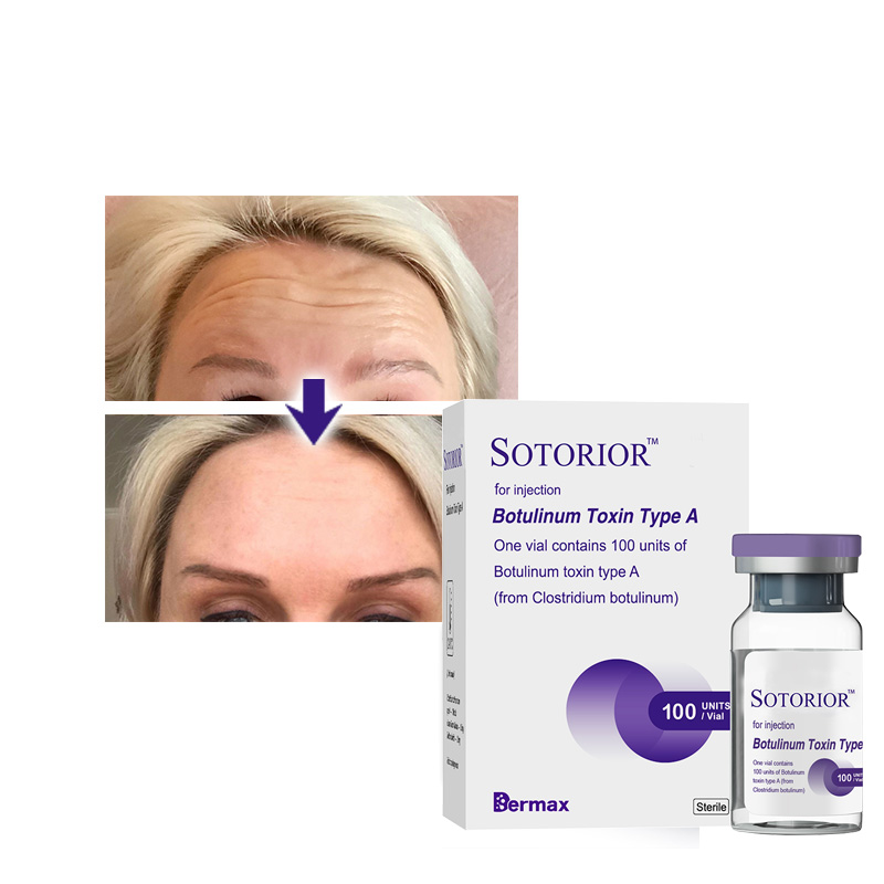 where can i buy botulinum toxin online