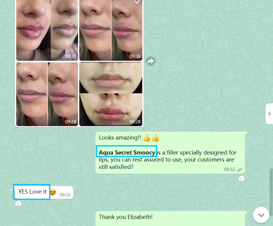 Lip filler customer feedback