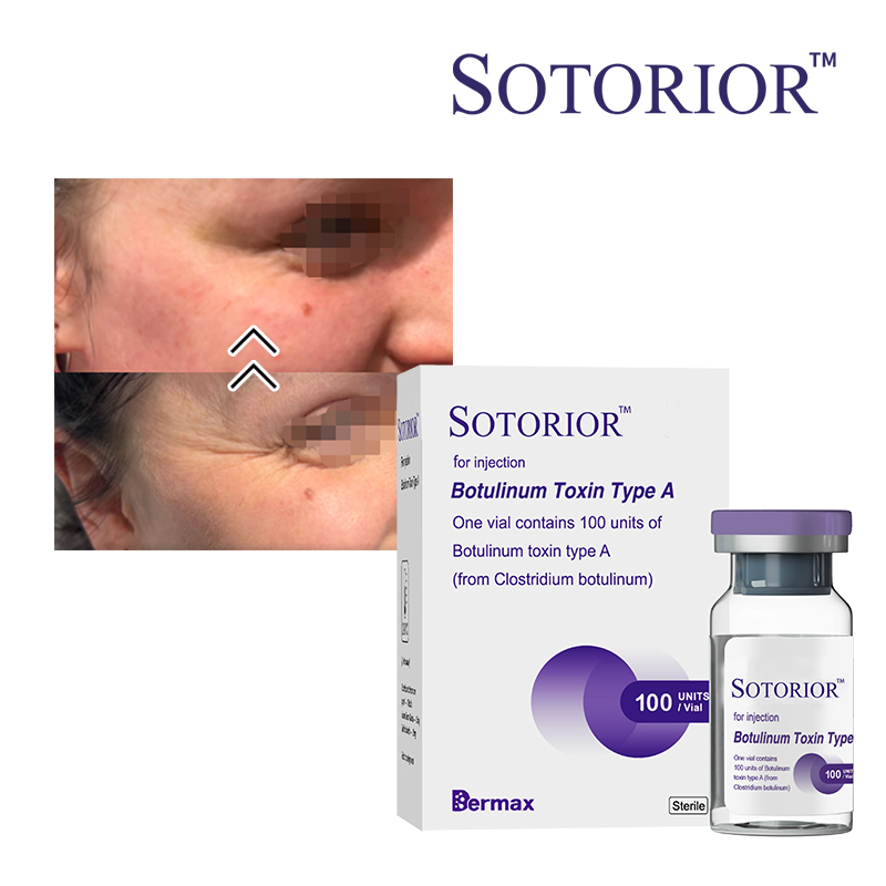 use of botulinum toxin for cosmetic purposes