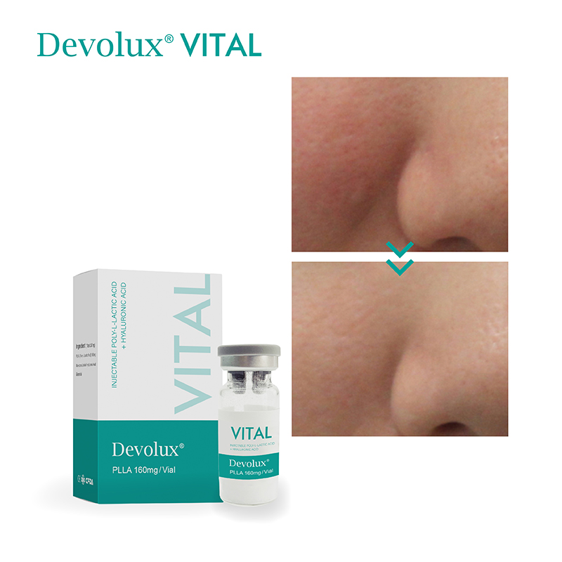 plla filler product 