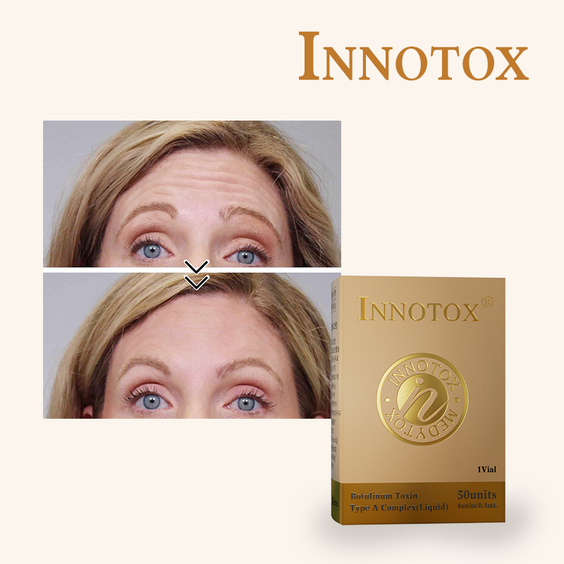 innotox 50 units botulinum toxin cost