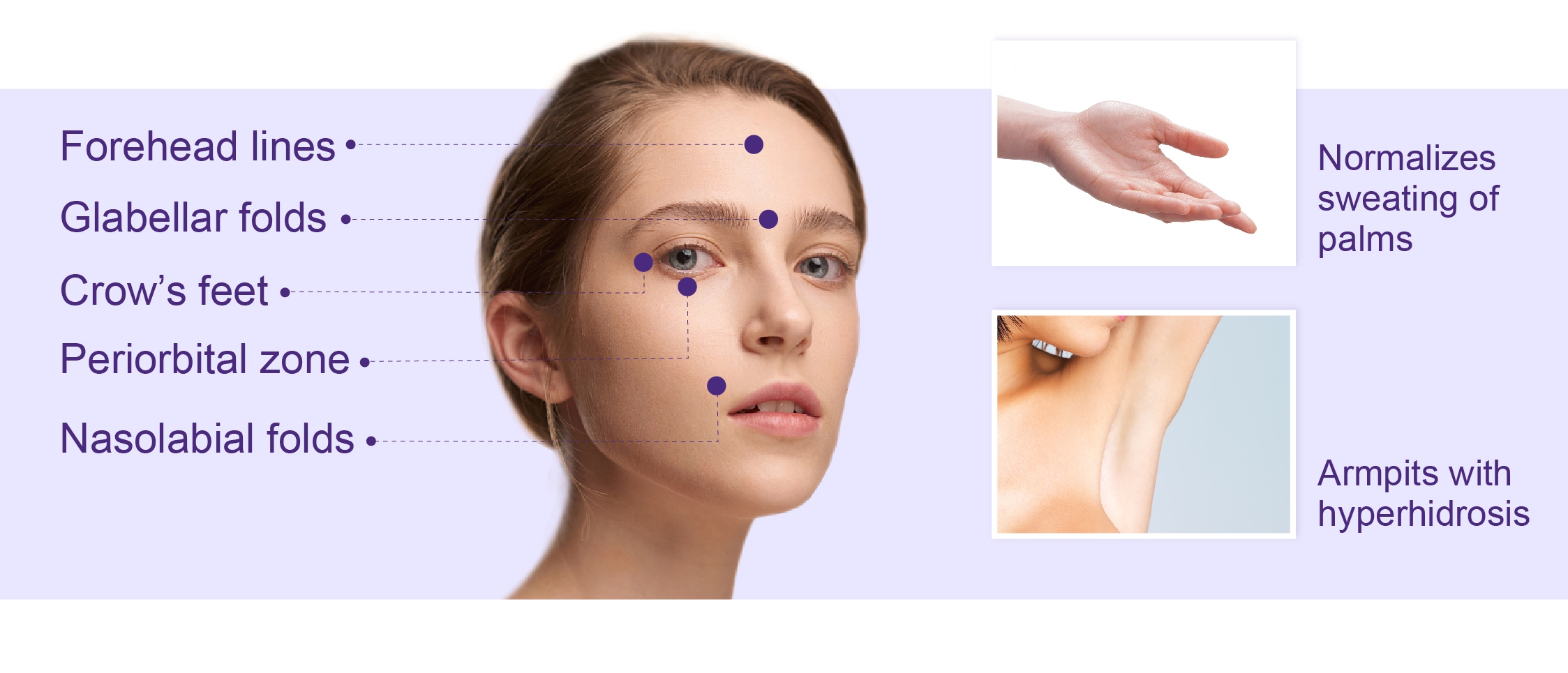 botulinum toxin type a treatment area