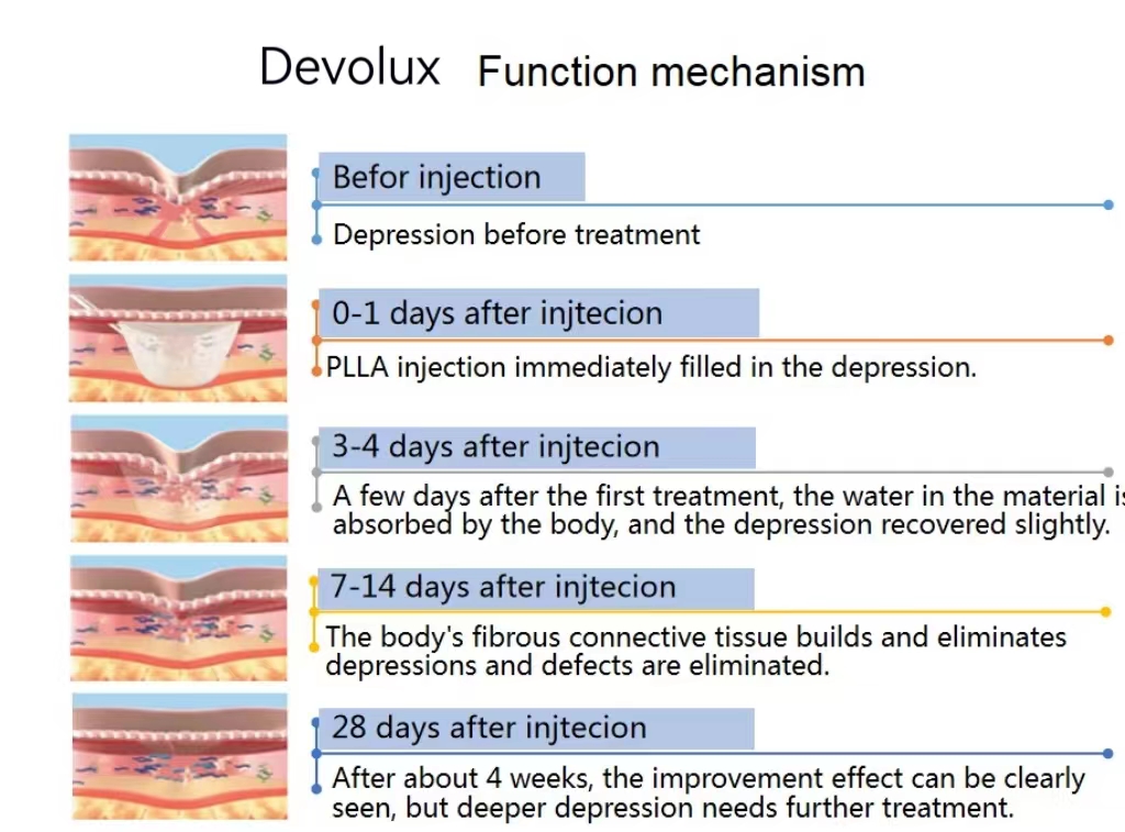 poly-l-lactic acid filler cost