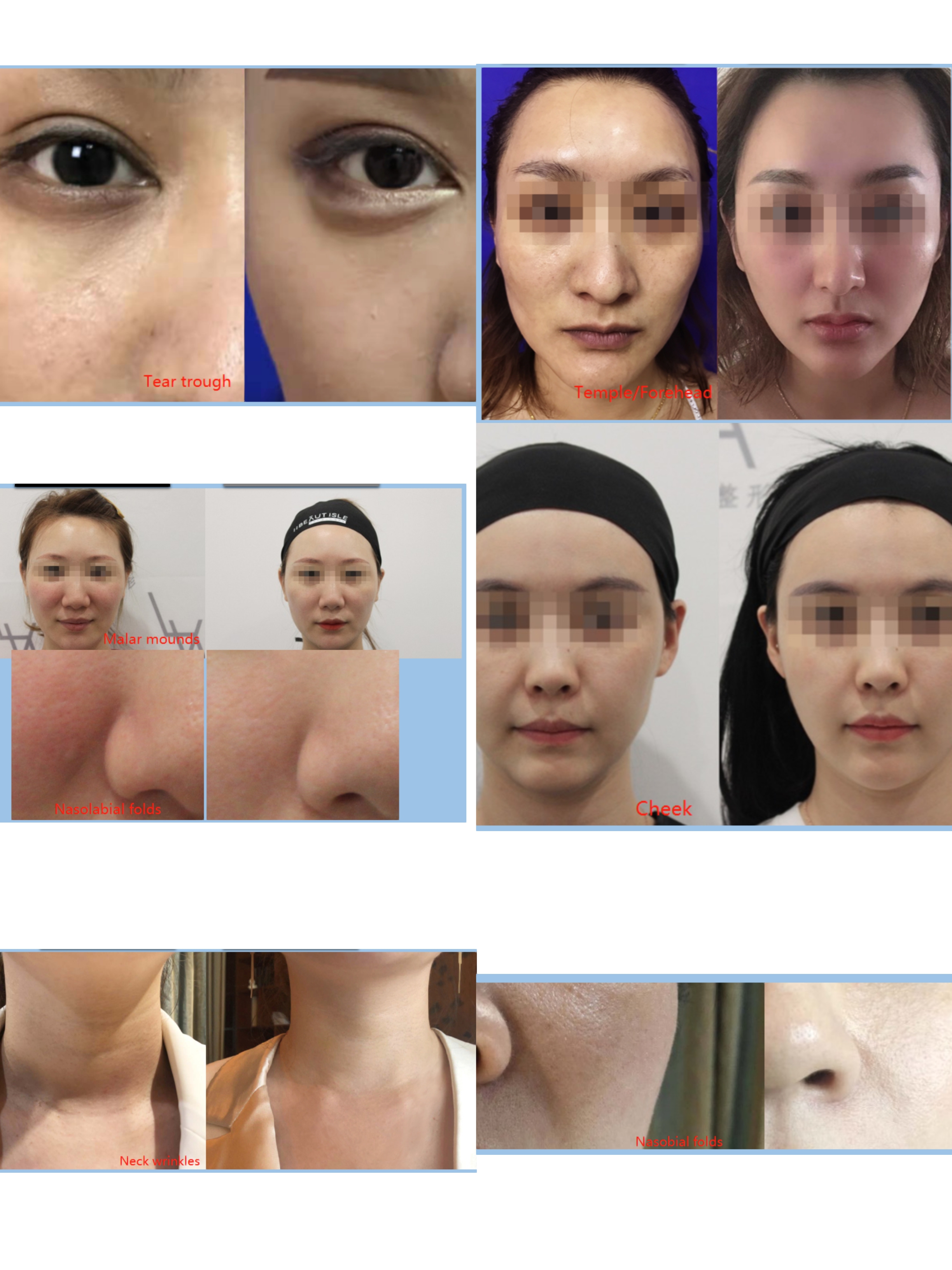 full face Devolux before and after photos