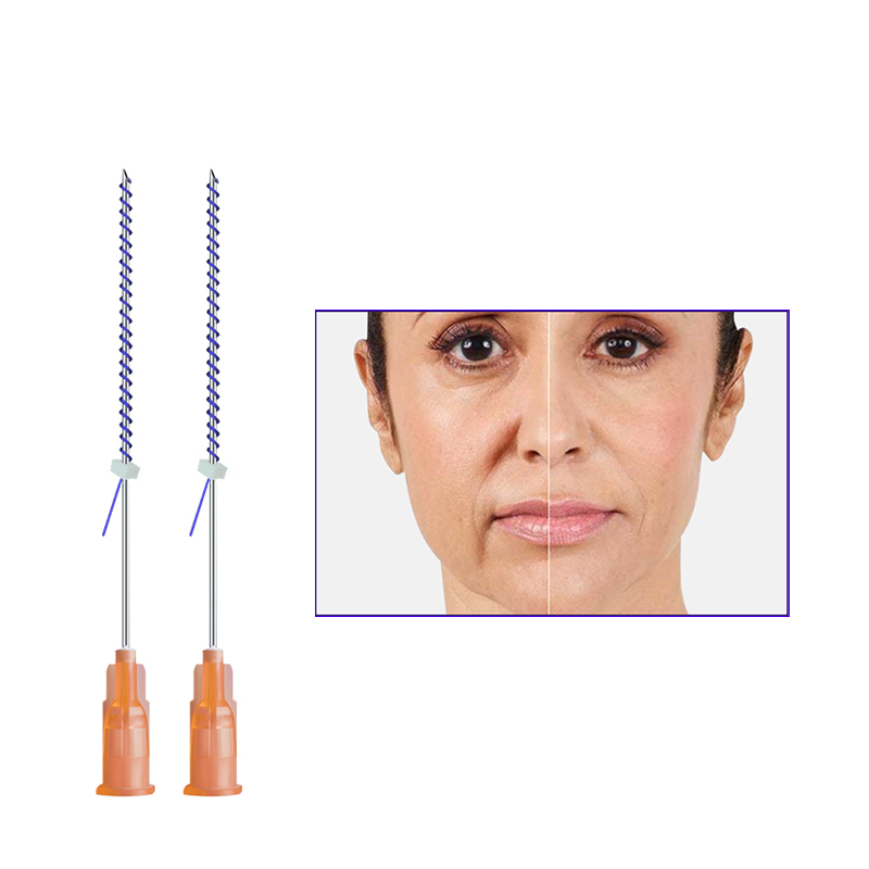 Magik Thread Before And After PDO Thread Lift For Eyes