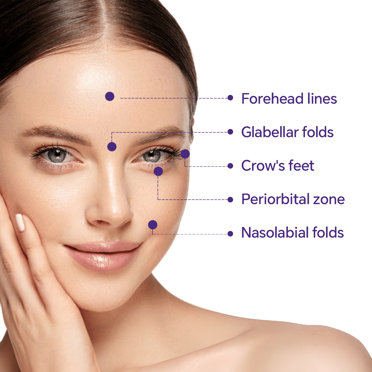 botulinum toxin type a treatment areas