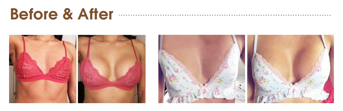 breast enlargement injections