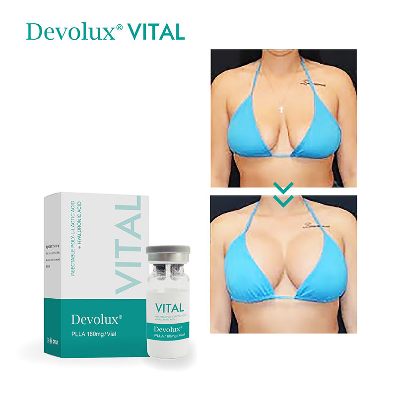 body devolux before and after photos