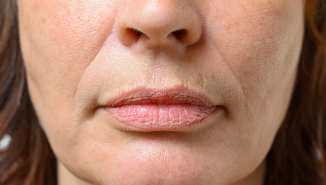 buy botulinum toxin cost wholesale price