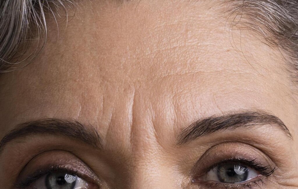 buy botulinum toxin cost wholesale price