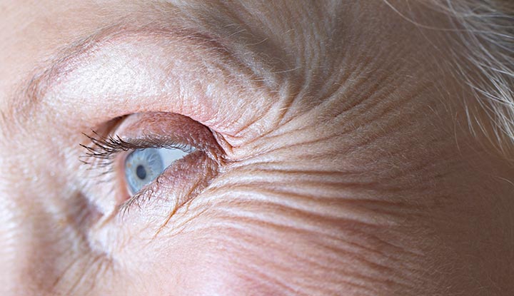 buy botulinum toxin cost wholesale price