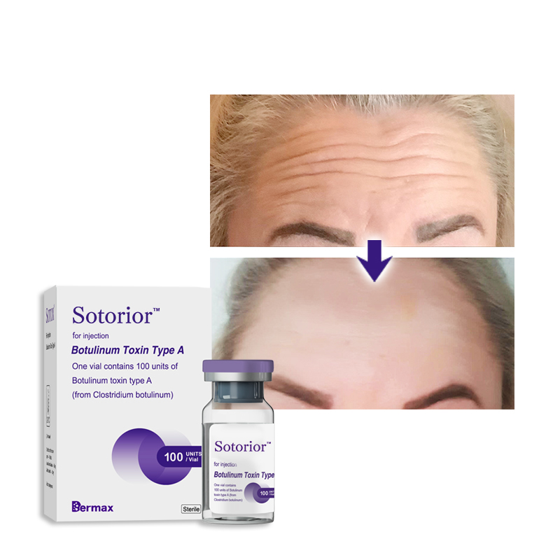 buy botulinum toxin cost wholesale price