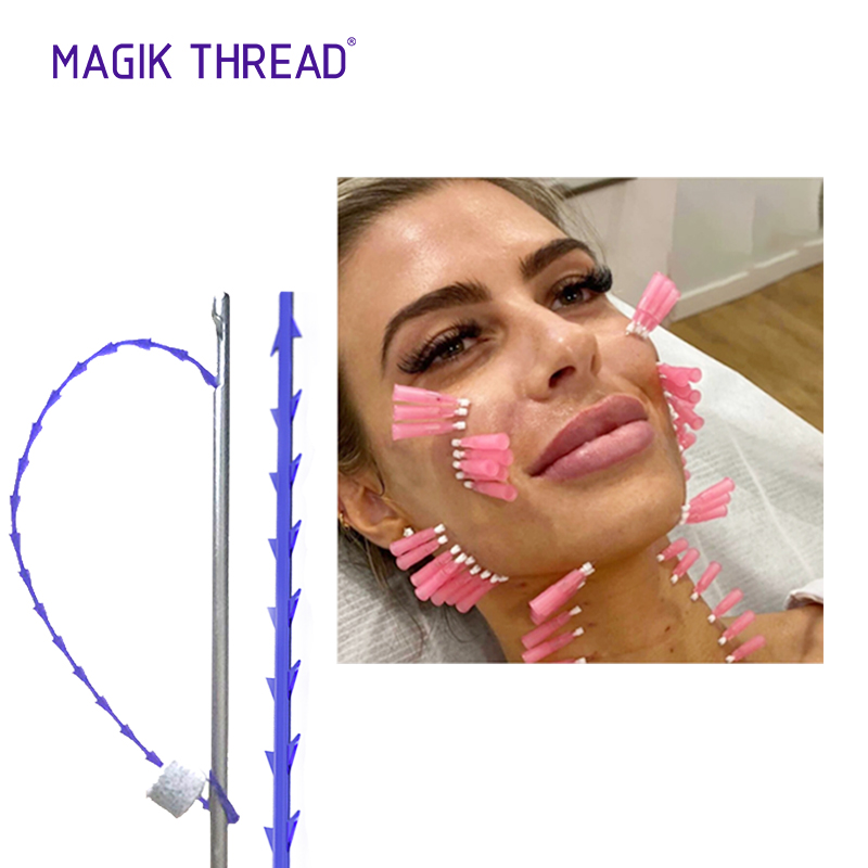 Magik Thread® Barbed PDO Threads