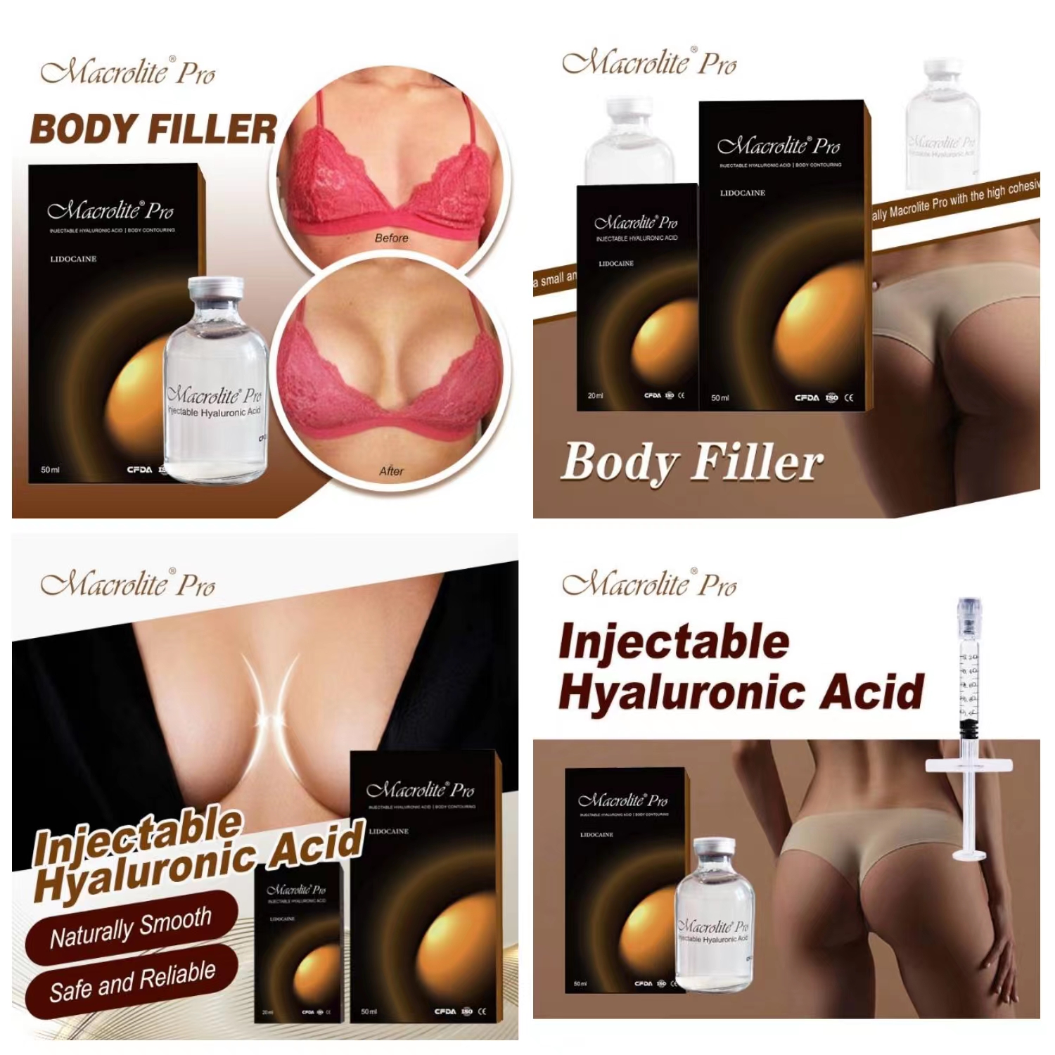 Macrolite body filler from Lluvia to Tammy