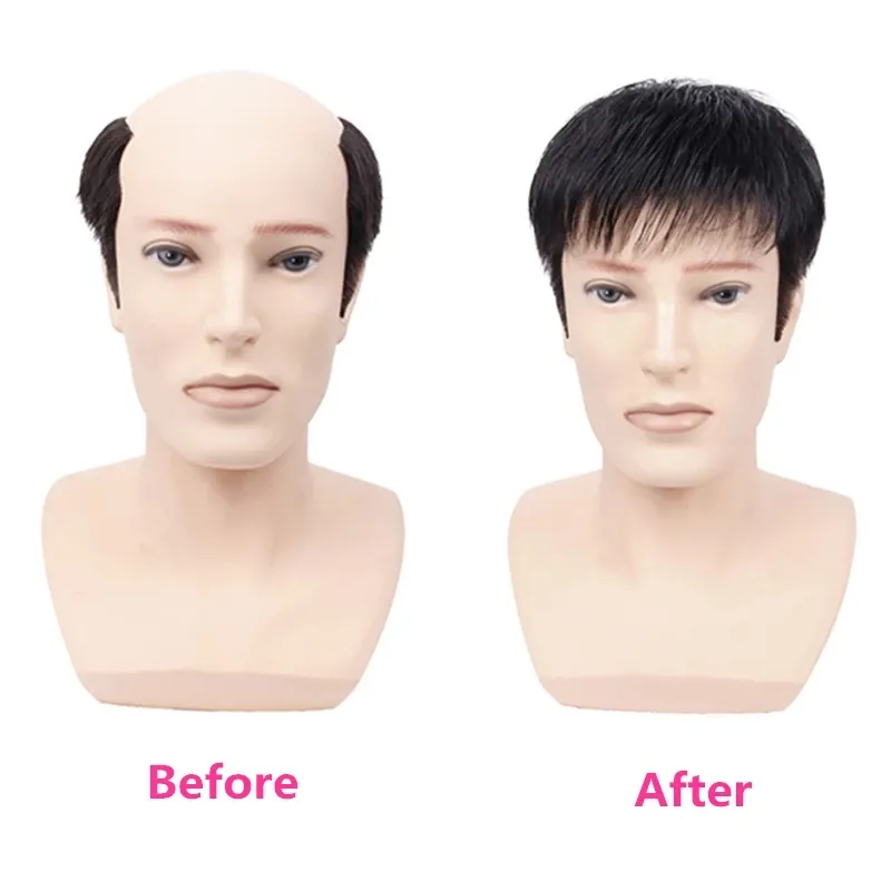 Men's Wig Thick Human Hair Toupee with PU Around Hair Replacement System Prosthetic Hair Wig Male Pieces For Men Baldness