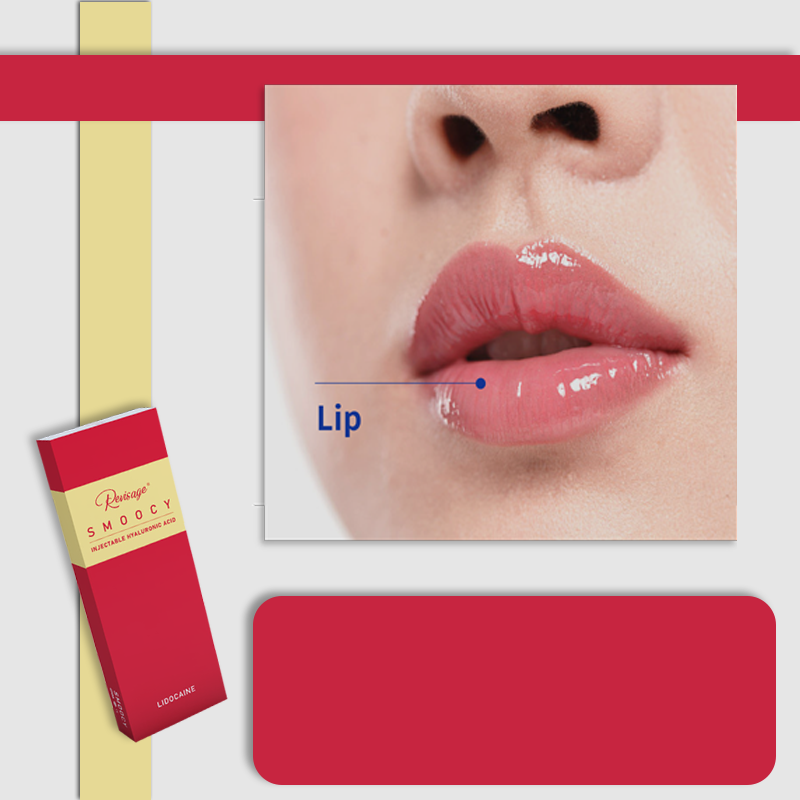 Lip Fillers price 