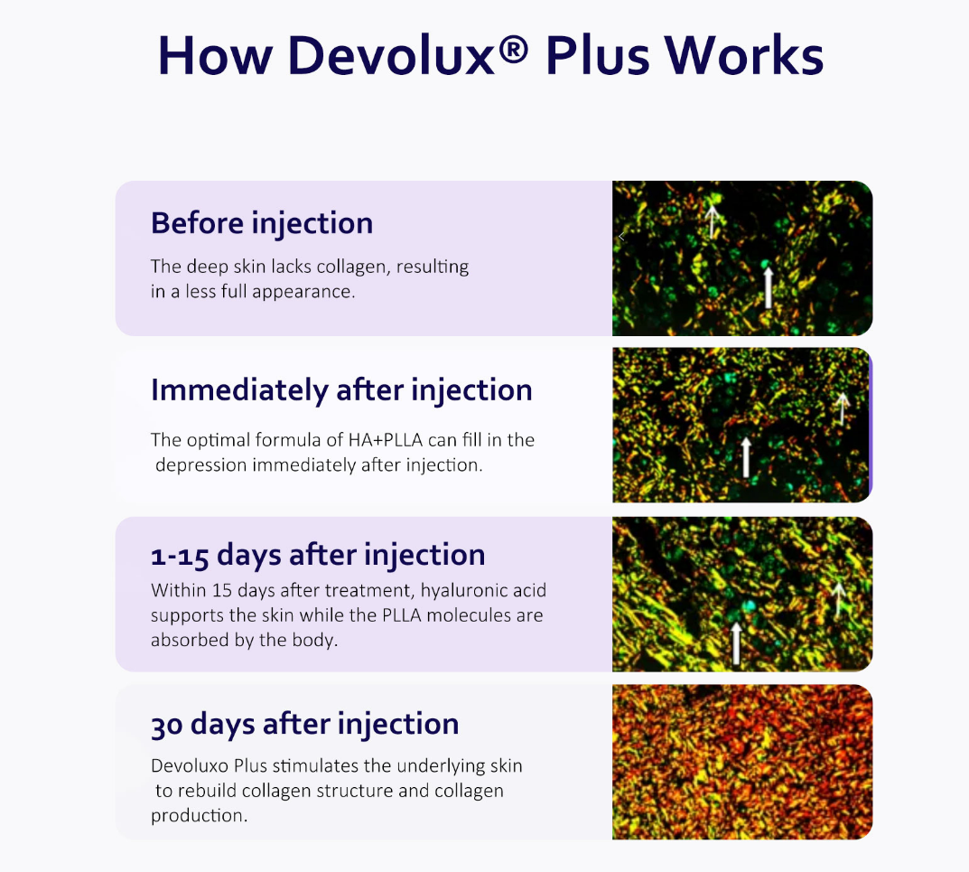 How Devolux® Plus Works