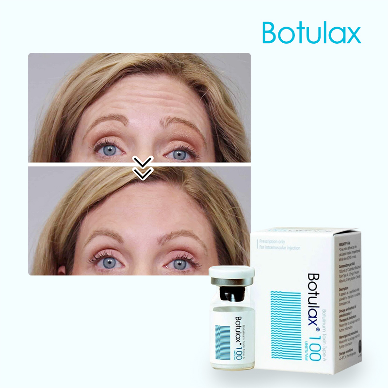 Nabota botulinum toxin type a Price