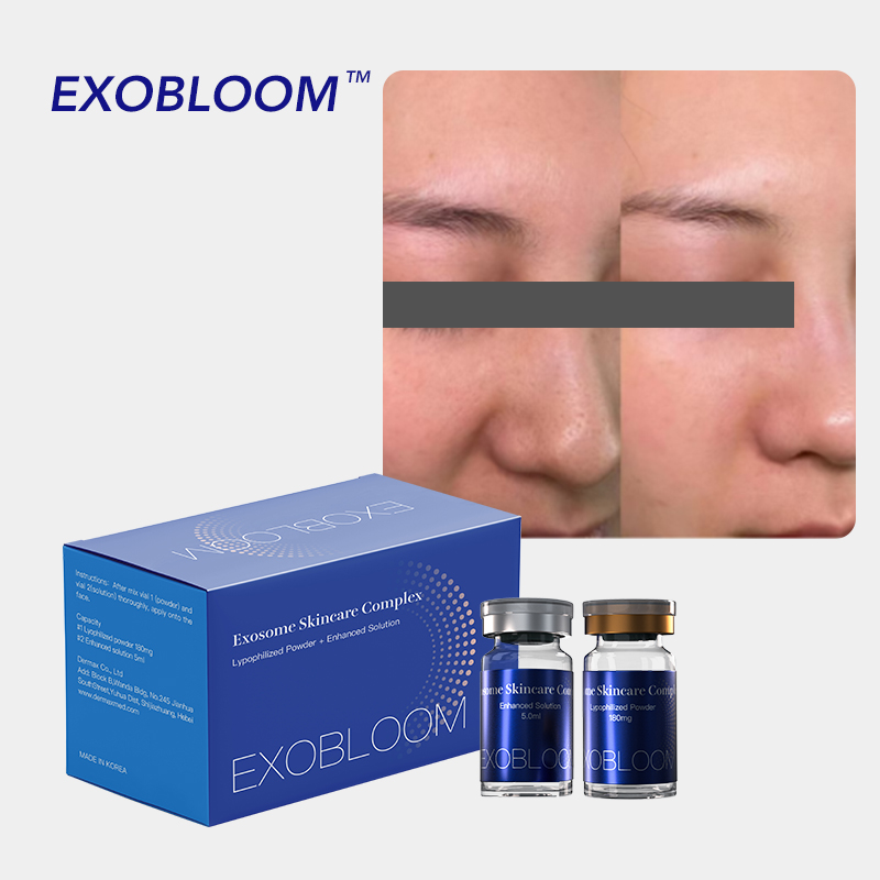  EXOBLOOM Exosome products