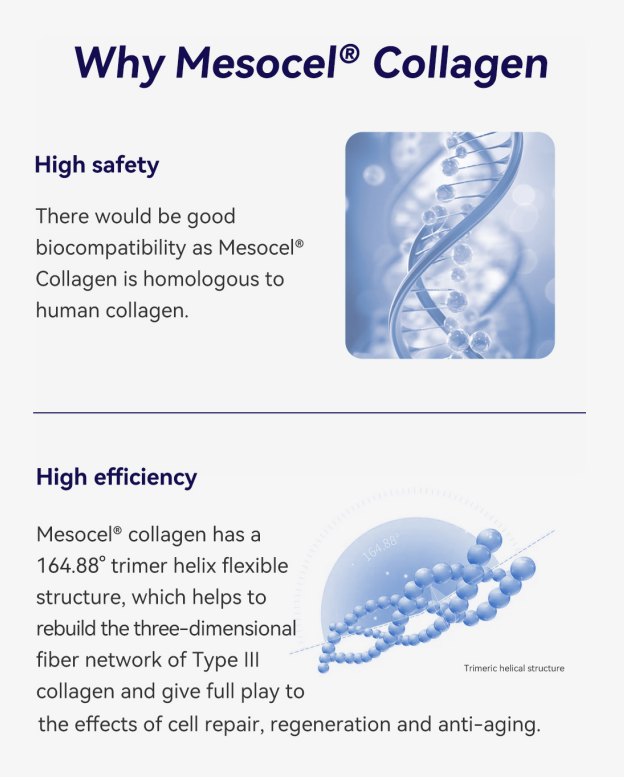 Why Mesocel Type III Collagen injections