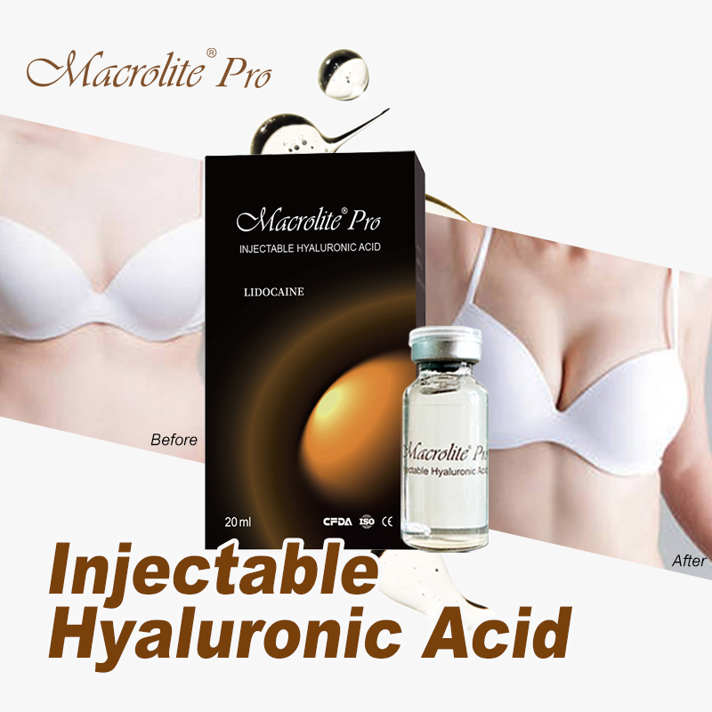 Macrolite® Pro Before & After